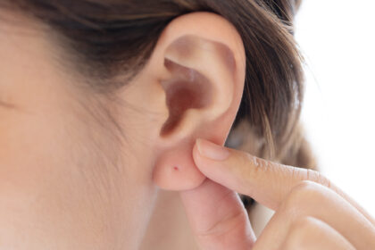ピアスの穴あけは医療行為