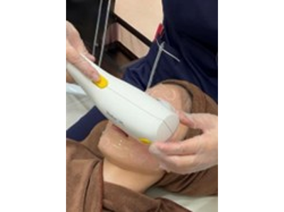 光照射(フォトフェイシャル)